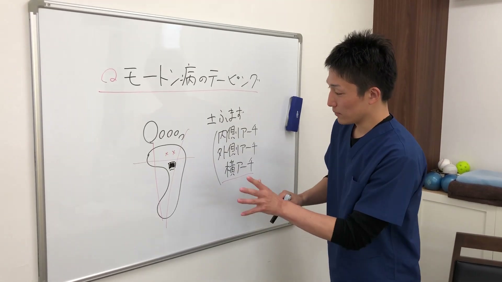 モートン病と足の横アーチの崩れを解説するホワイトボード